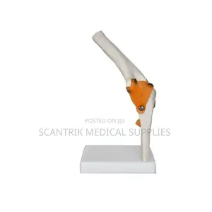 Exam-Ready Elbow Ligament Model for Medical Students