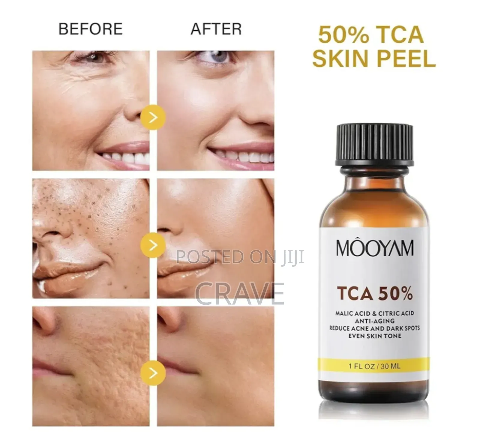 Mooyam Tca 50% Peel