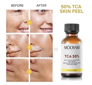 Mooyam Tca 50% Peel