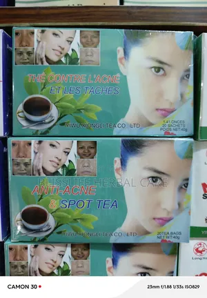 Anti Acne and Spot Removal Herbal Tea