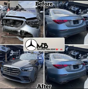Complete Upgrade Both Front and for E350 2010 to 2018/21