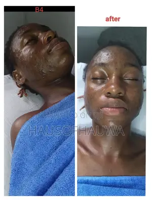 Spa Therapists In Ikorodu