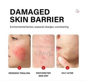 Mooyam Of15 Minutes Sos Rescue Facial Spray