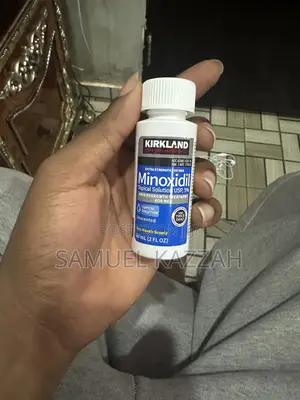 Minoxidil Topical Solution