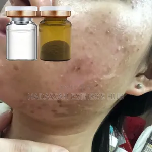 Algae Skin Peel Powder and Solution for Wrinkles, Dark Spots Corrector
