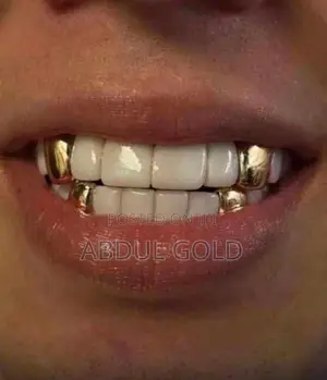 Gold Teeth