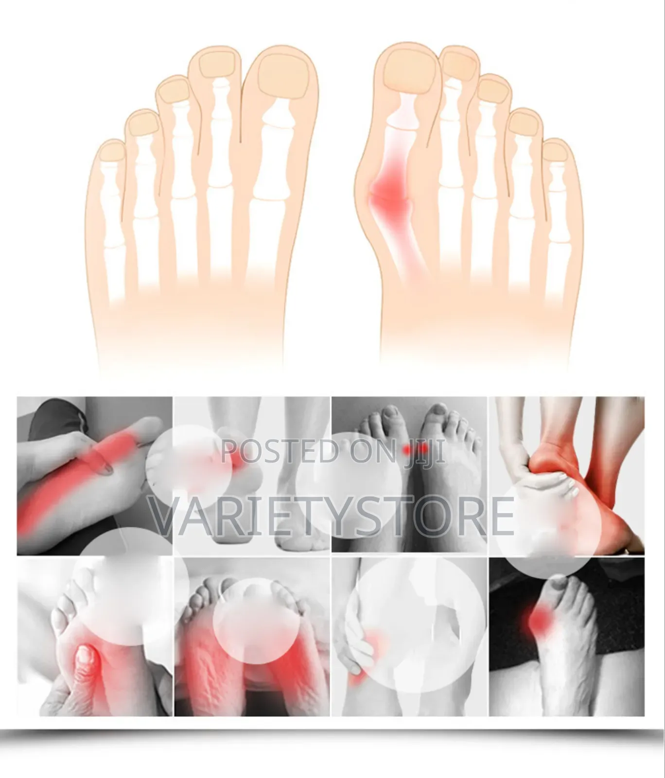 Toes Separator Socks Thumb Adjuster Straightener