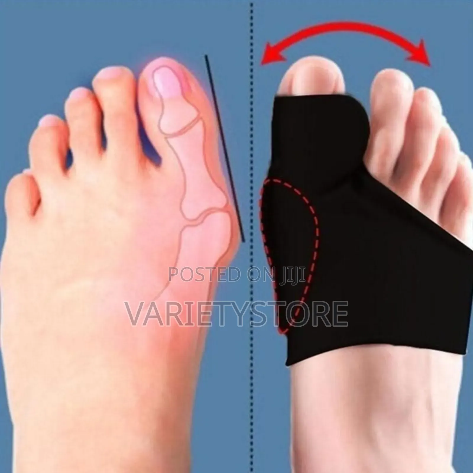 Toes Separator Socks Thumb Adjuster Straightener
