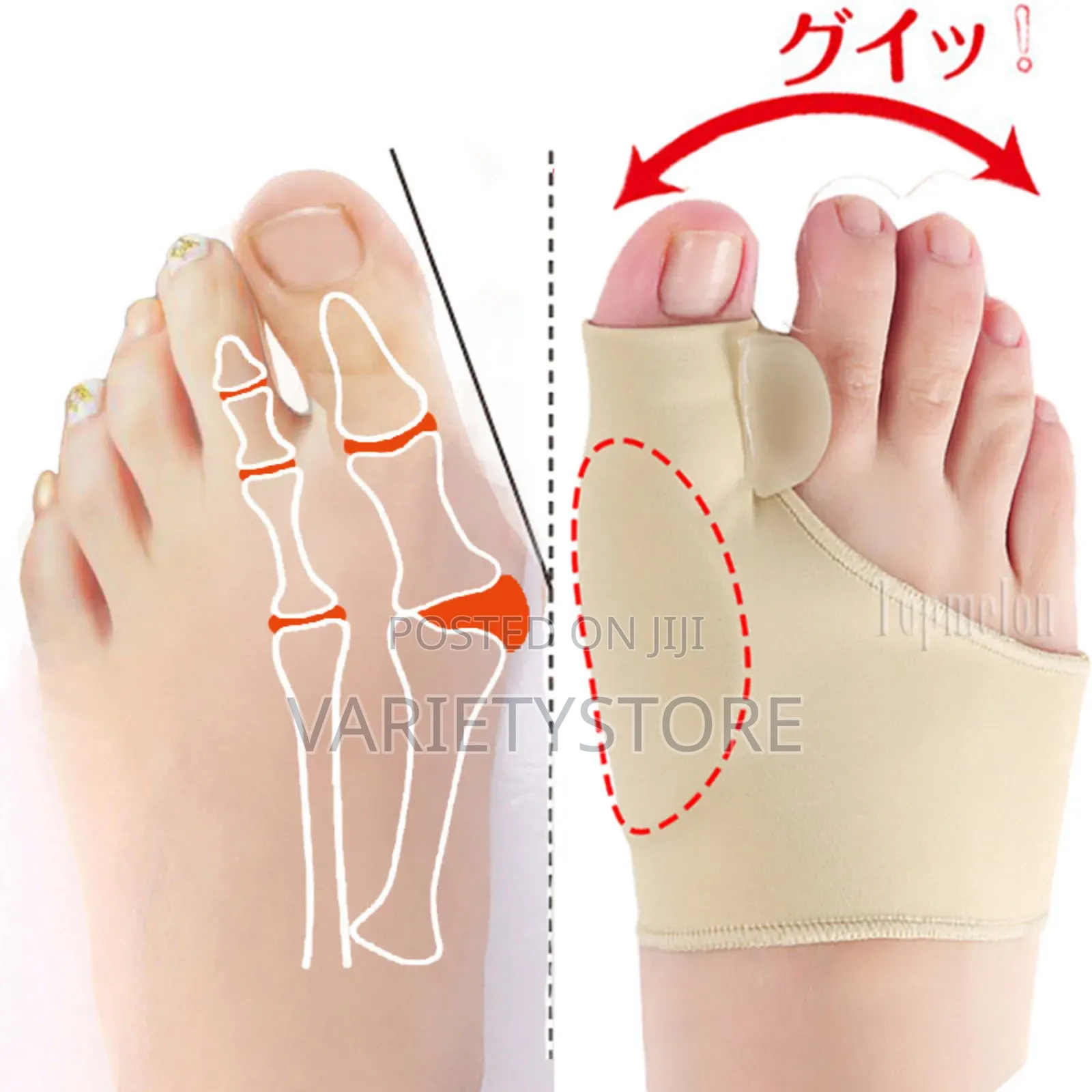 Toes Separator Socks Thumb Adjuster Straightener