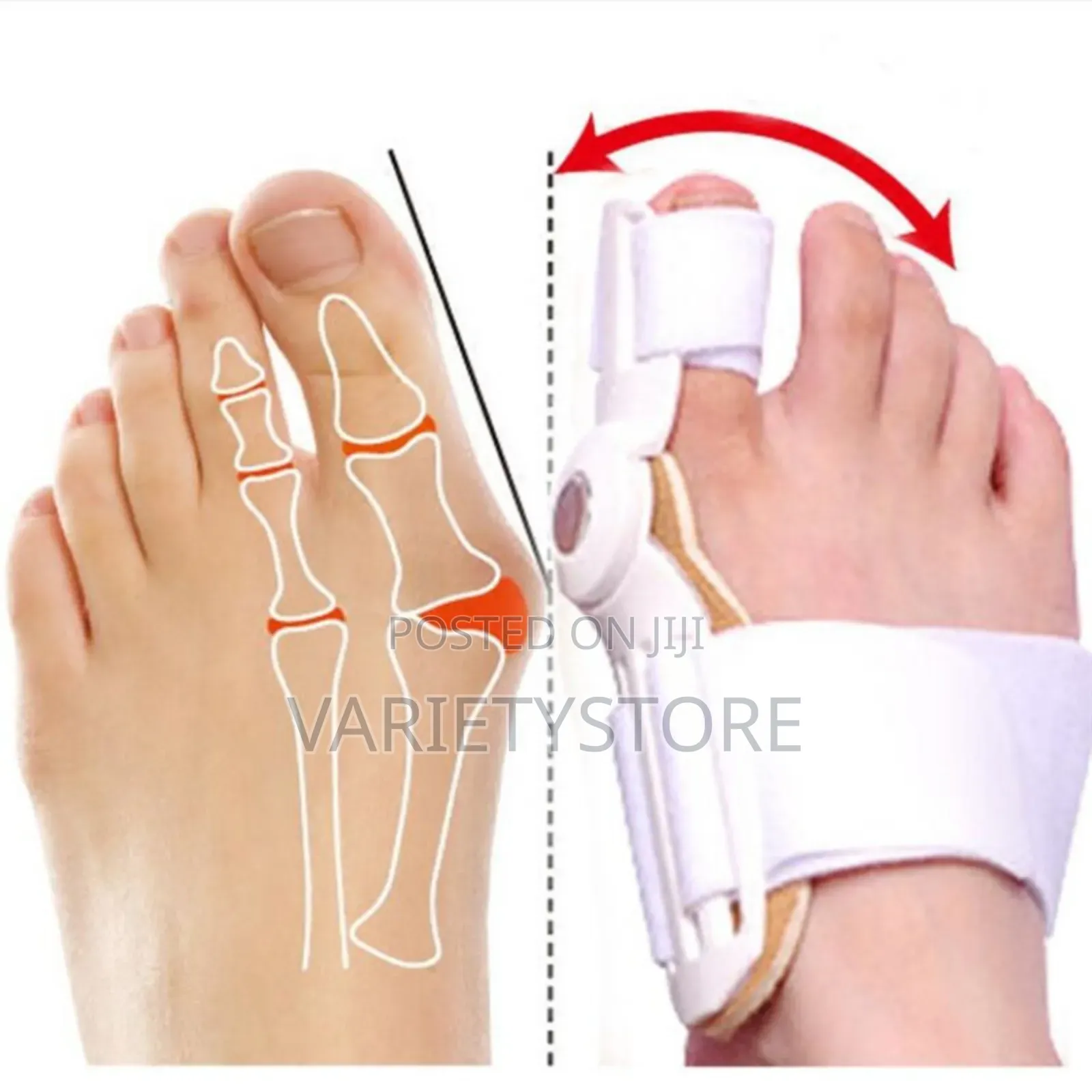 Big Toe Straightener Corrector Foot Hallux Valgus Correction
