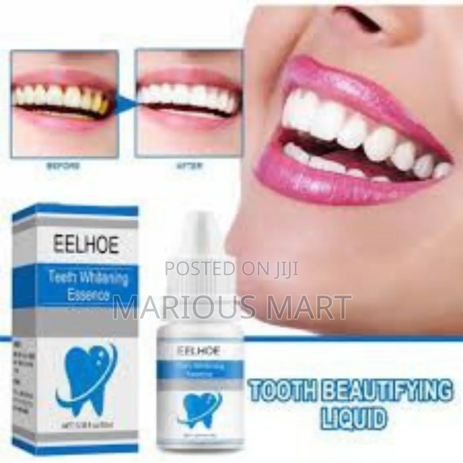 Eelhoe Teeth Whitener