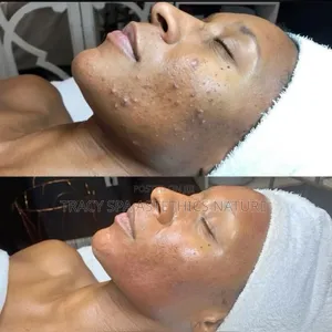 Facials Makes You Beautiful