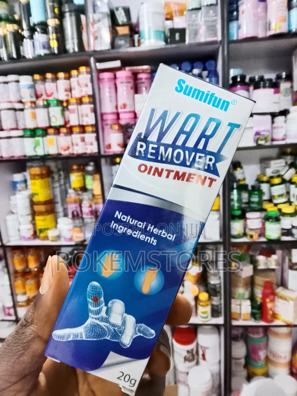 Wart Remover