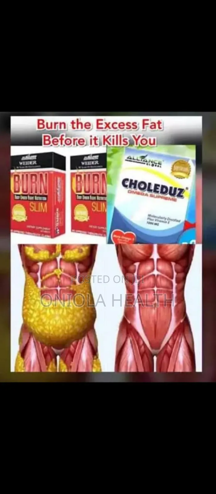 Choleduz Omega Supreme
