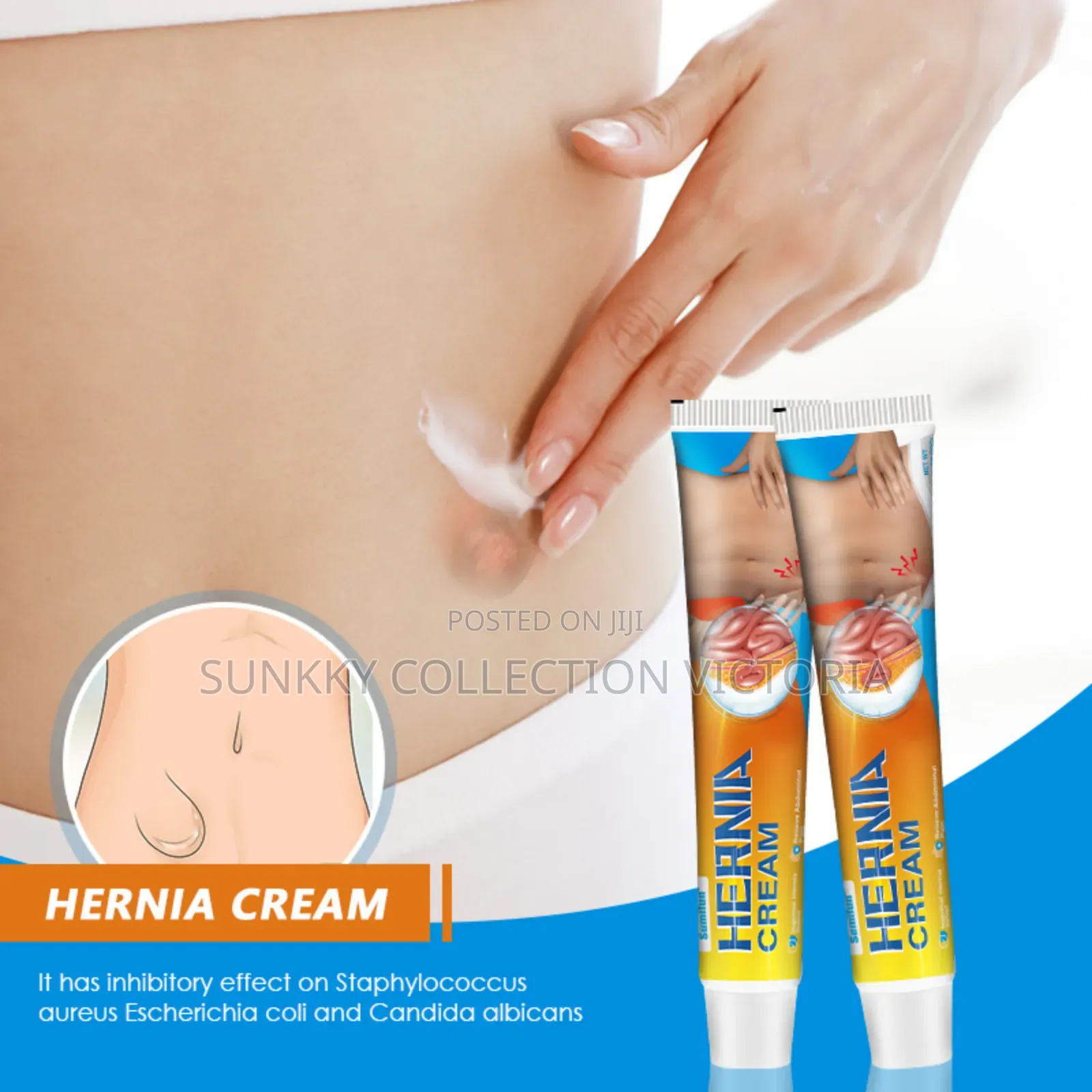 Hernia Treatment Ointment Decrease Abdominal Wall Pressure