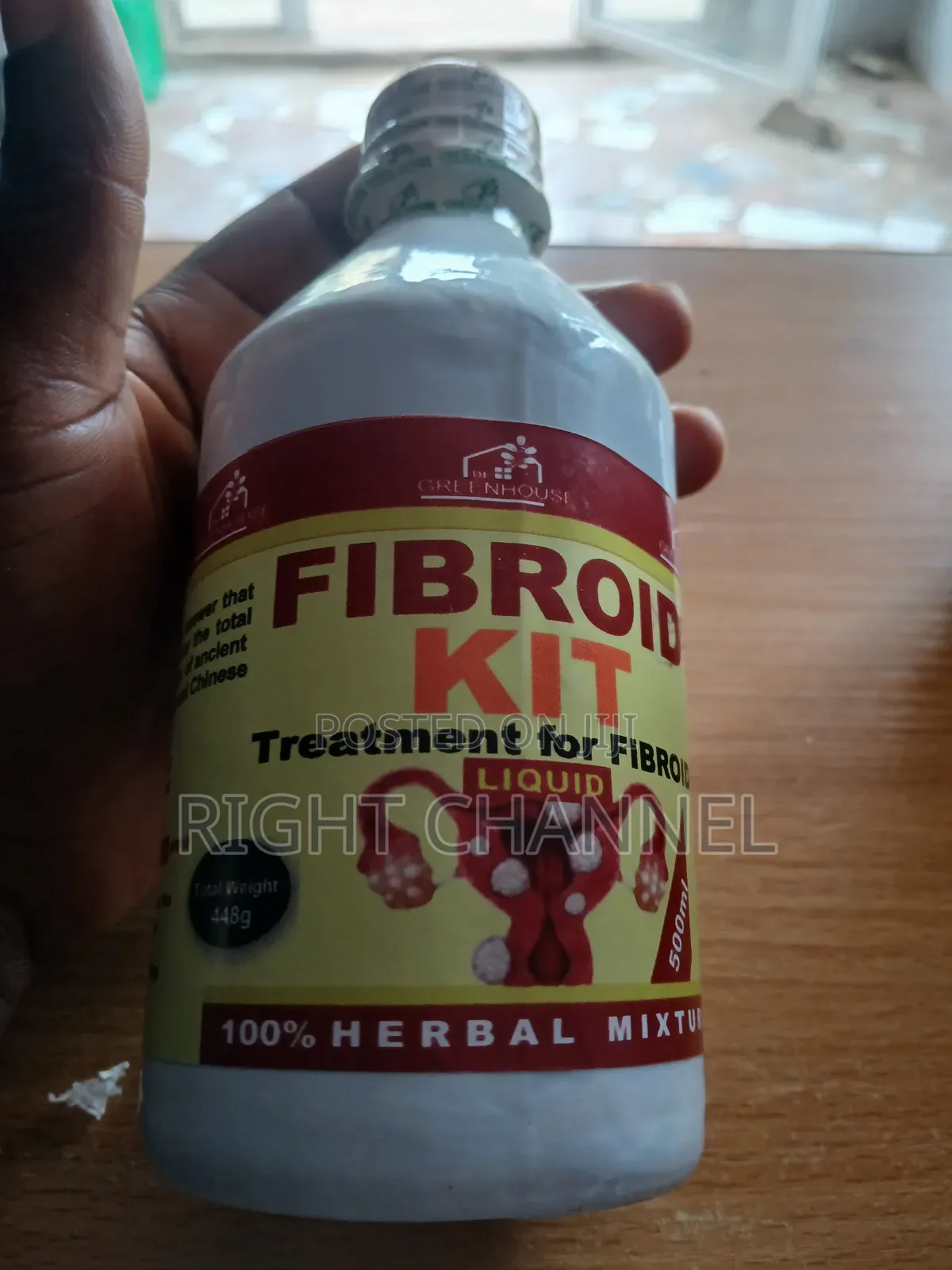 Fibroid Kit