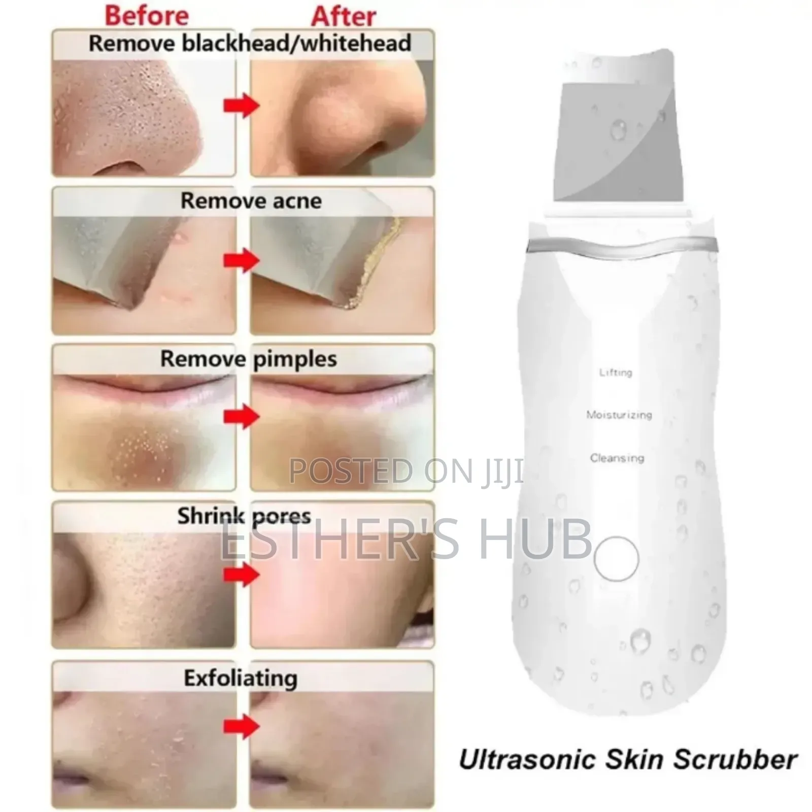 Ultrasound Skin Scrubber Device