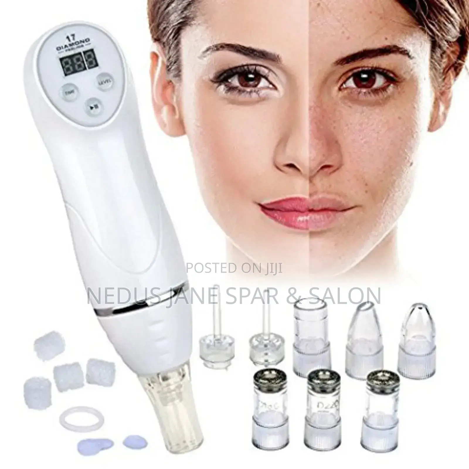 Diamond Dermabrasion Gadget