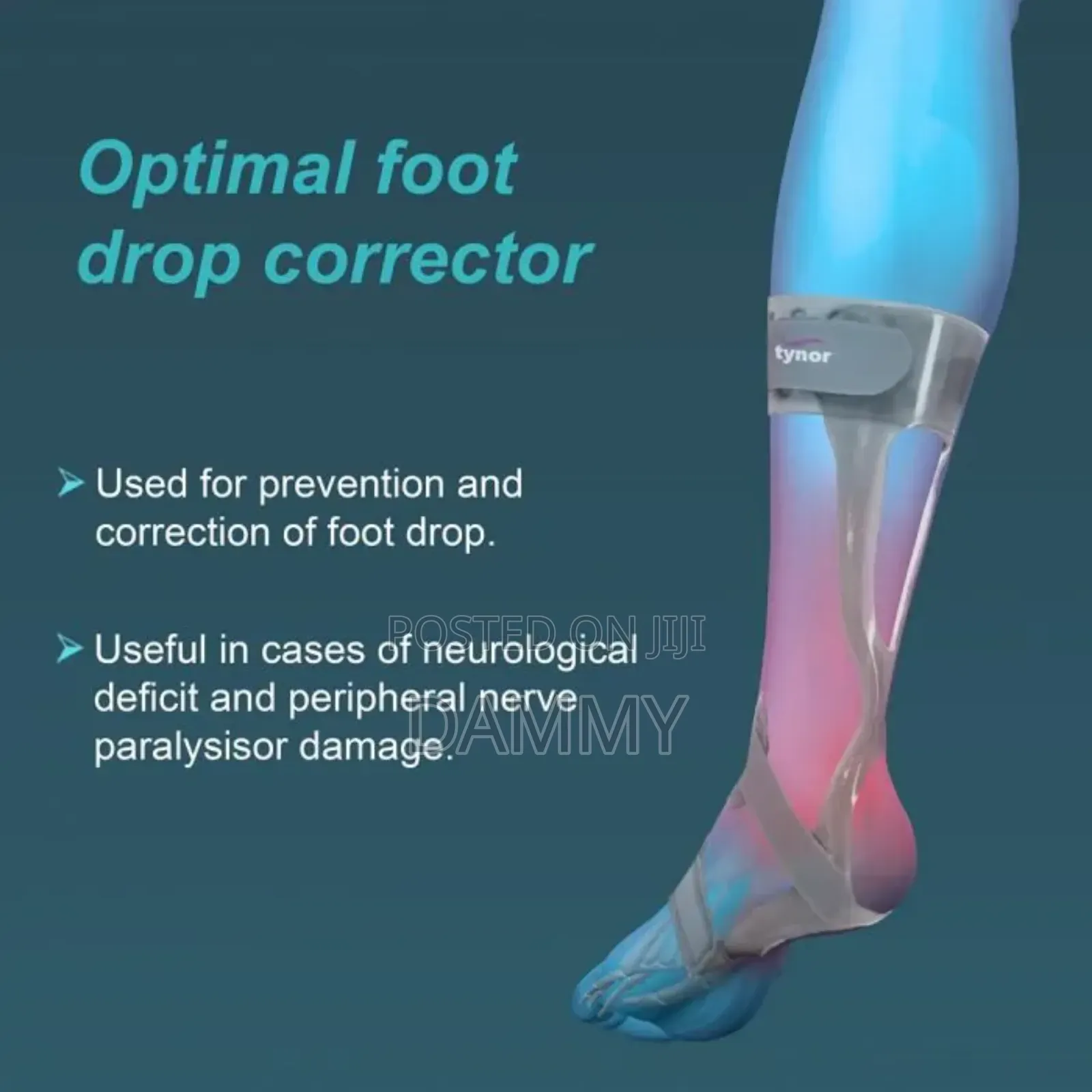 Tynor Foot Drop Splint