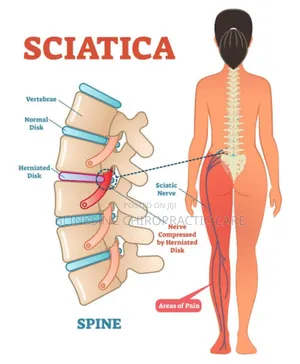 Chiropractic and Physiotherapy Care