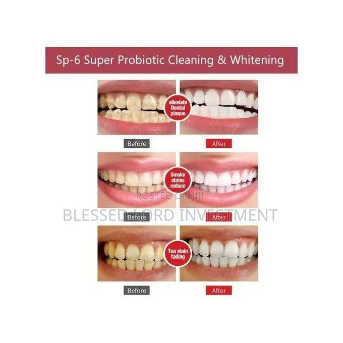2-in-1 Sp-6 Probiotic Toothpaste