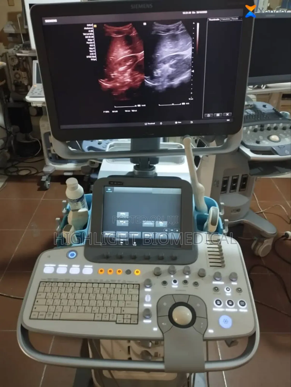 Siemens Acuson Nx3