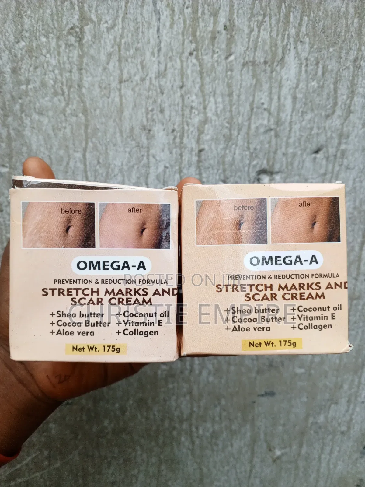 Omega-a Stretch Marks and Scar Cream