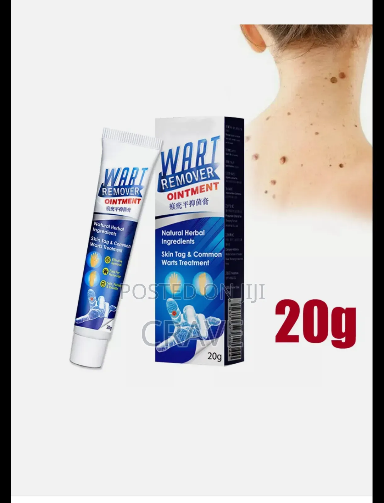 Instant Action Wart Removal - Remove Skin Tags Quick Wart Removal.