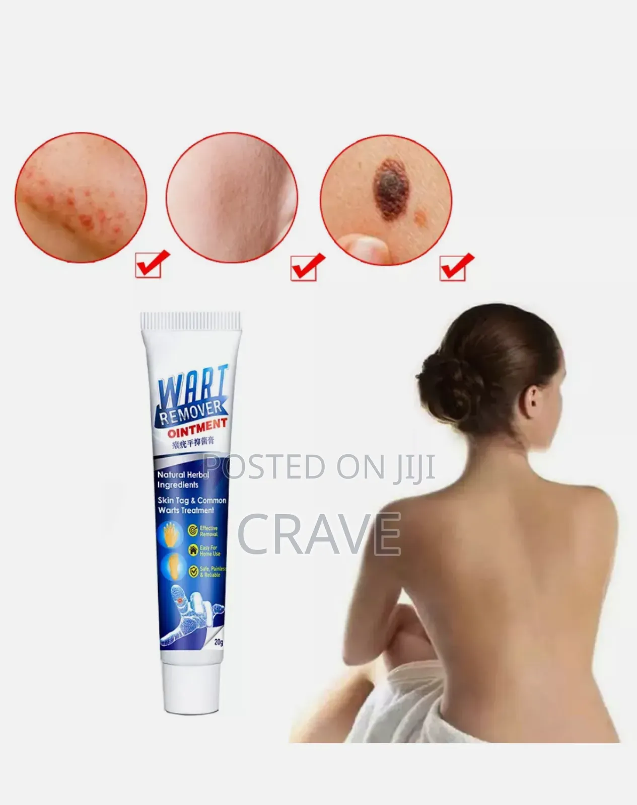 Instant Action Wart Removal - Remove Skin Tags Quick Wart Removal.