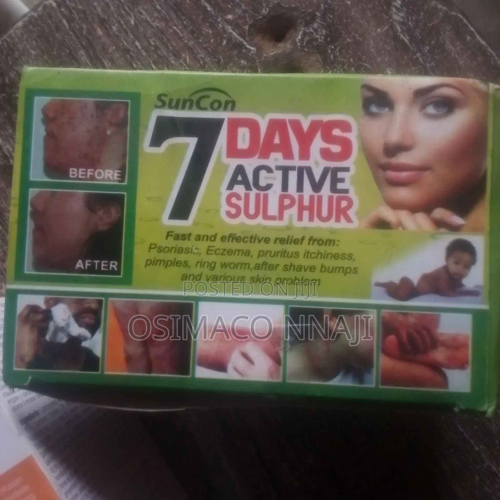 Green Tea and Immune Booster and Others