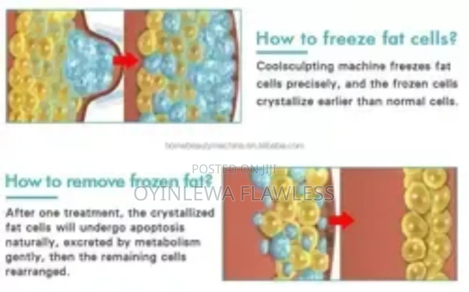 Cryotherapy Fat Freezing Body Sculpting Machine Pad