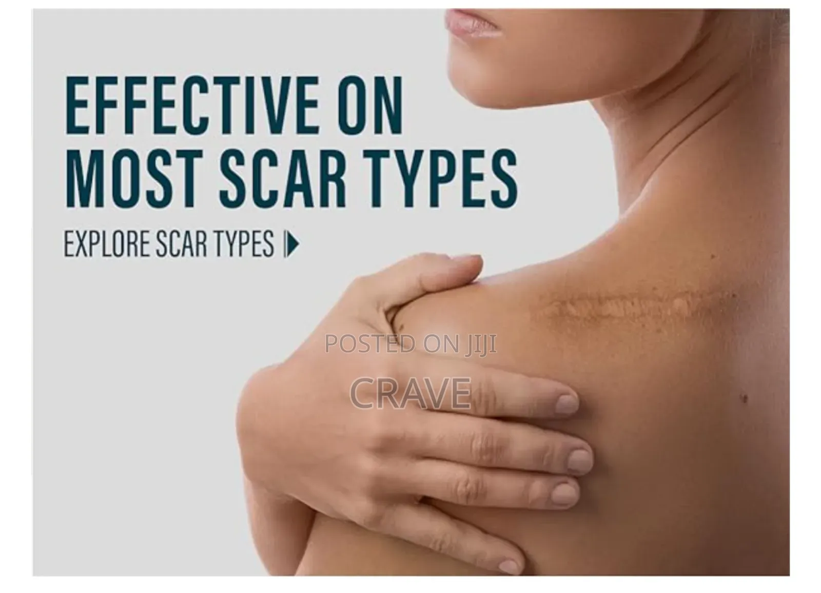 Kormesic Scar Sheet Treatment (1pcs)