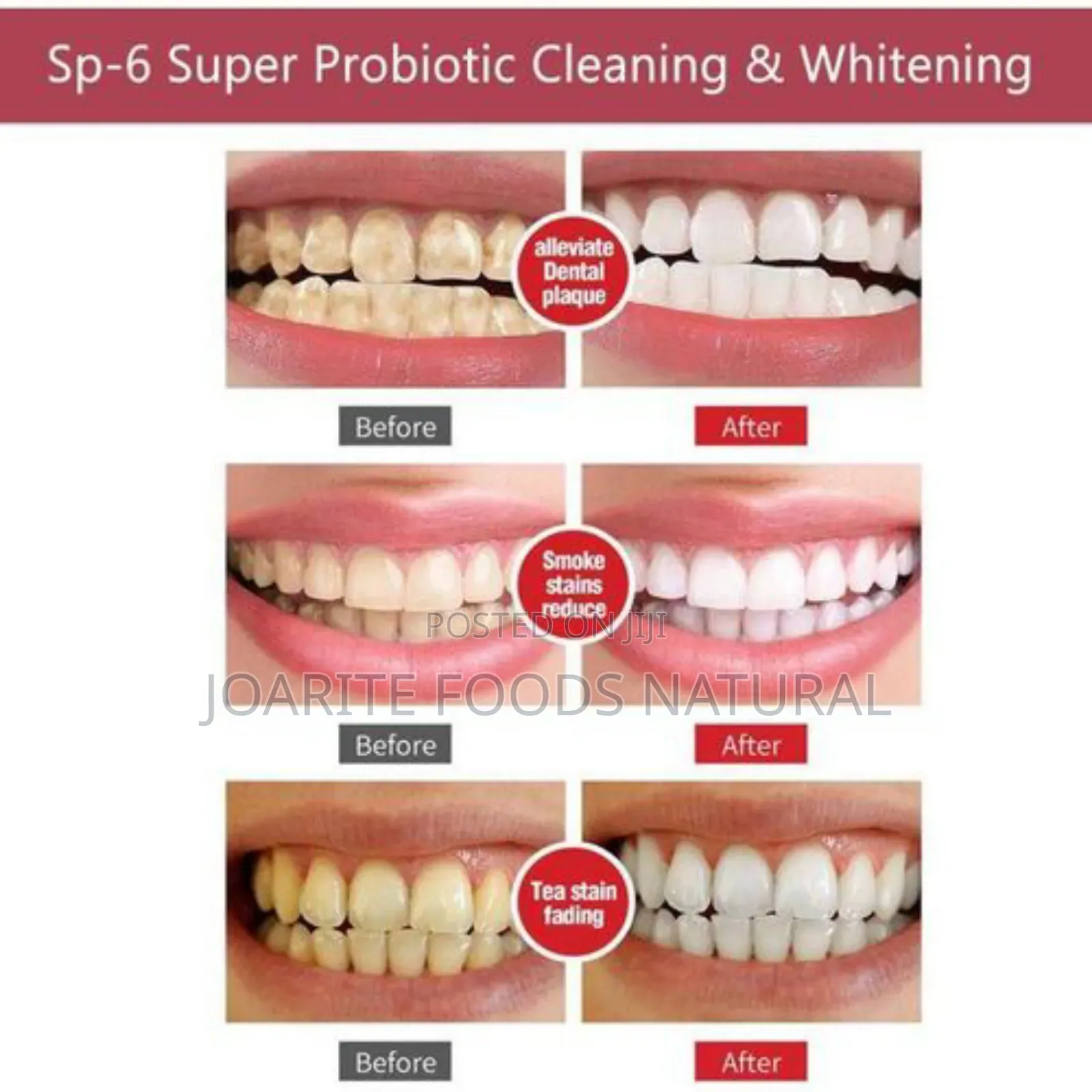 Sp-6 Probaotics Toothpaste