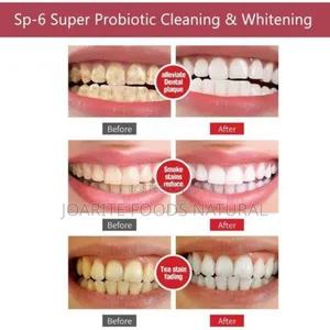 Sp-6 Probaotics Toothpaste