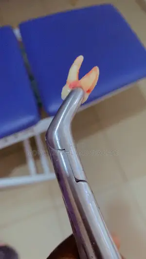 Teeth Extraction