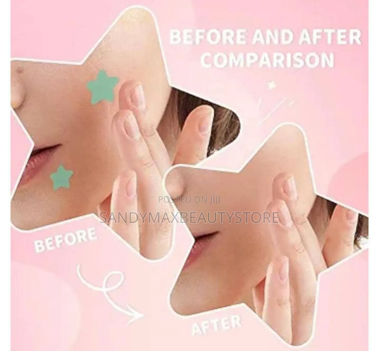 Pimples Patches