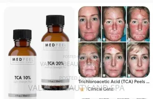 Face and Body Strong Peeling Oil