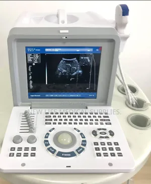 Ultrasound Scanning Machine 2d With Convex Probe