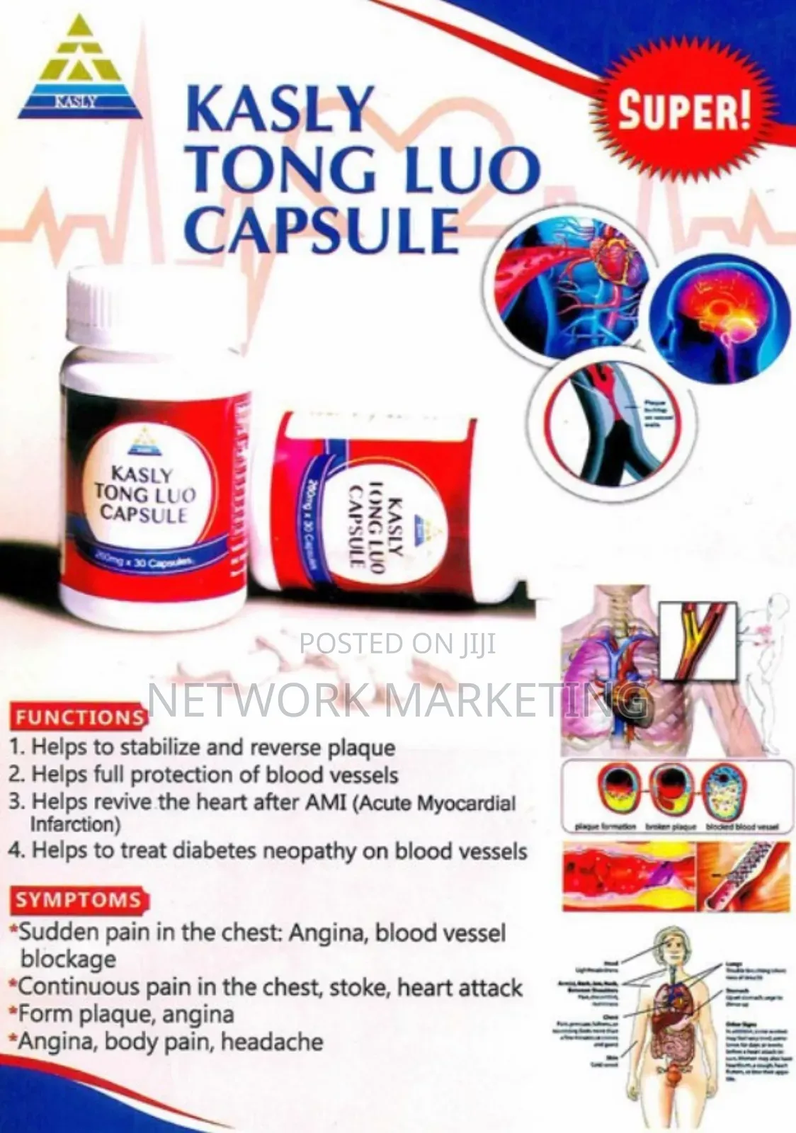 Kasly Tongluo Capsule