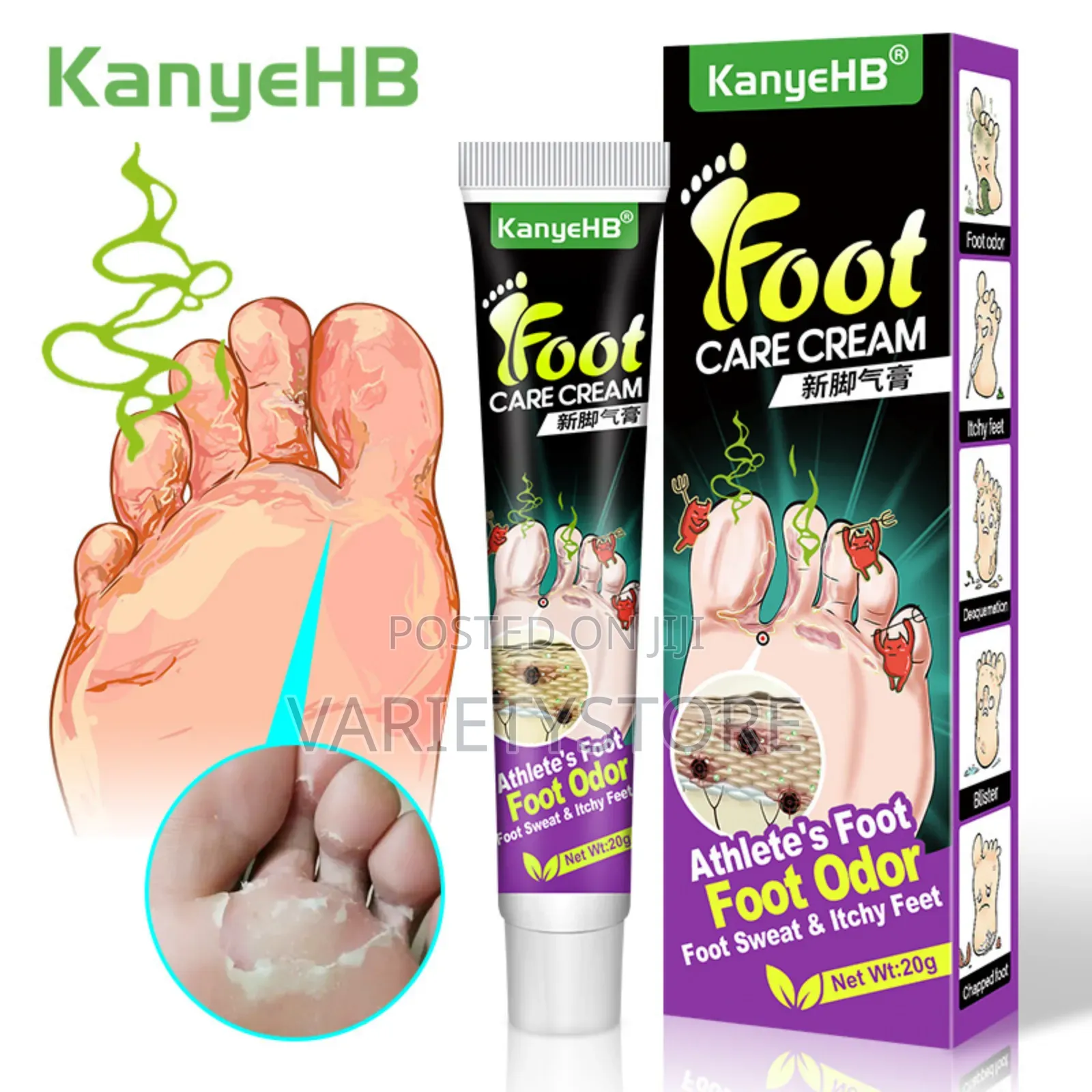 Foot Fungus Removal Cream Remove Beriberi