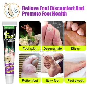 Foot Fungus Removal Cream Remove Beriberi