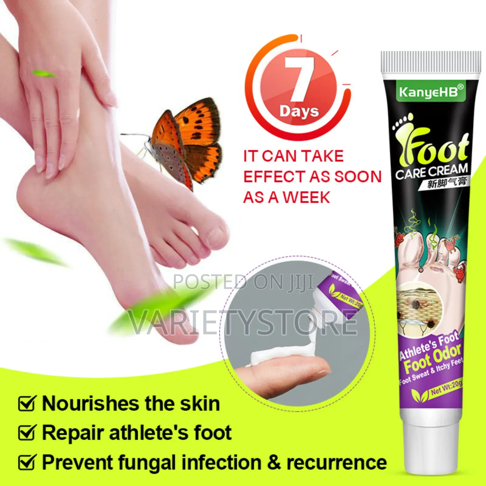 Foot Fungus Removal Cream Remove Beriberi