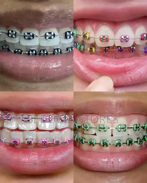 Teeth Fashion Braces