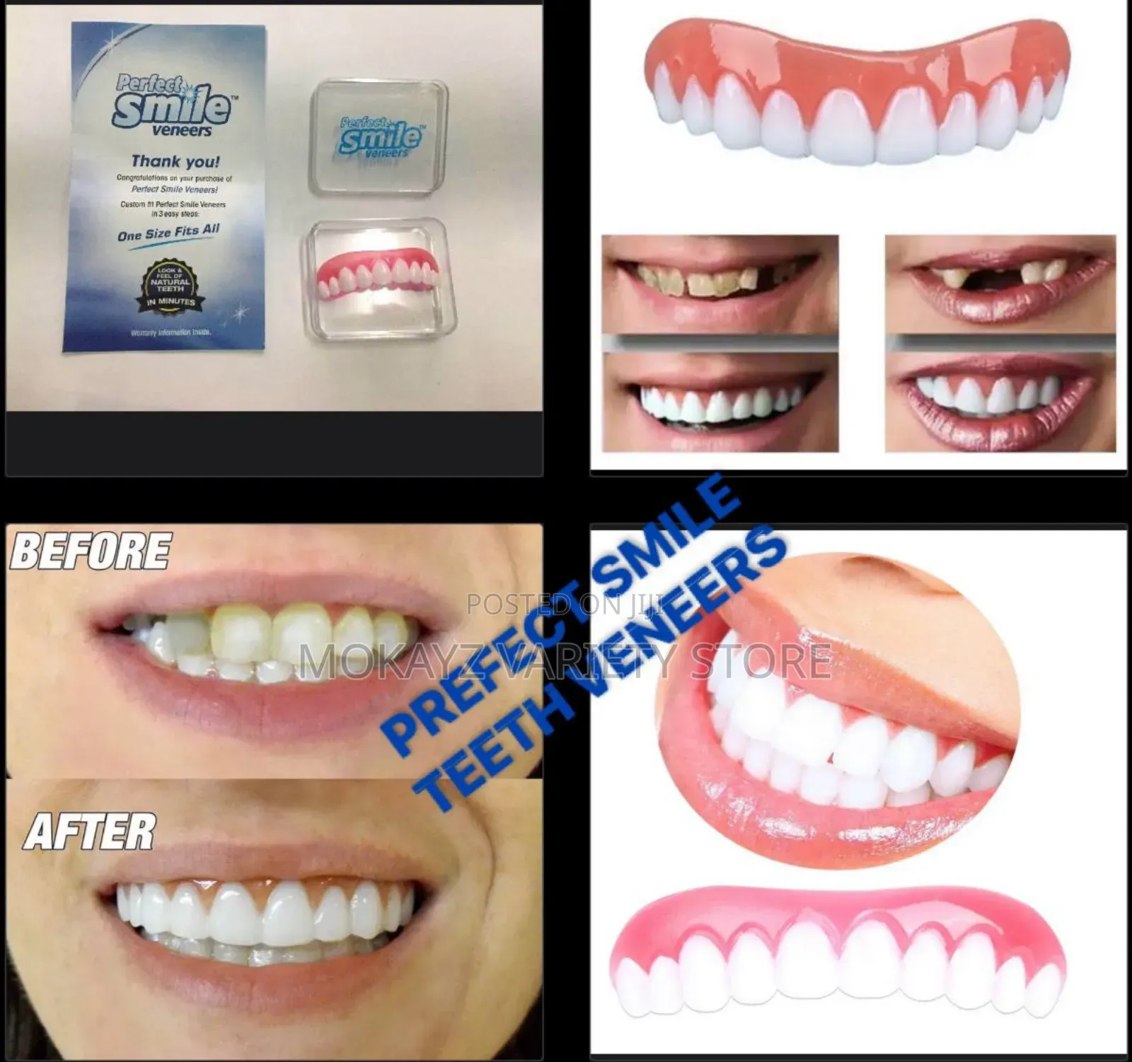 Perfect Smile Veneers - Reusable Teeth Whitening Silicone Teeth