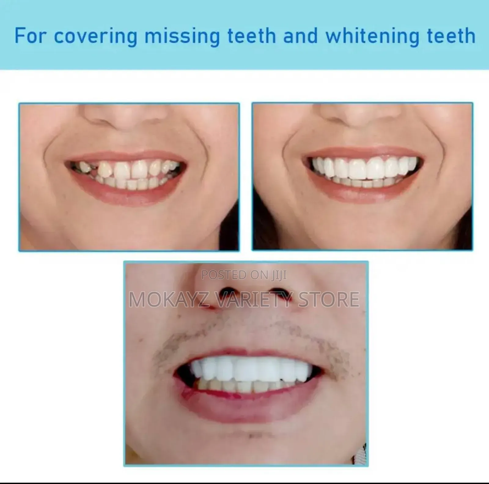 Perfect Smile Veneers - Reusable Teeth Whitening Silicone Teeth