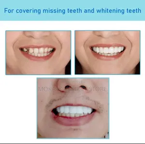 Perfect Smile Veneers - Reusable Teeth Whitening Silicone Teeth