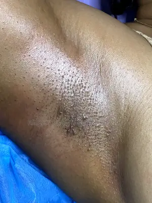 Body and Brow Waxing