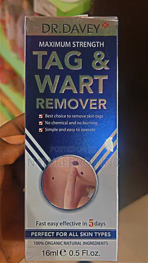 Tag and Wart Removal by Dr. Davey
