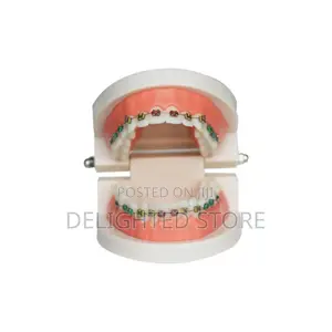 Dental Orthodontic Model Celebrity Decorative Fashionable Brace