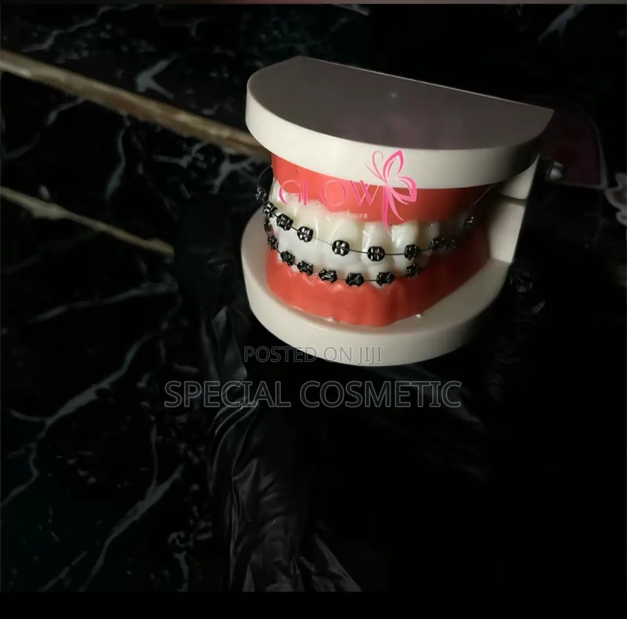 Fashion Braces
